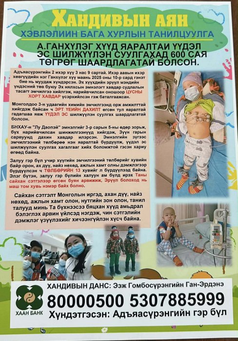 Ганхүлэг хүүд үүдэл эс шилжүүлэн суулгах эмчилгээнд 600 сая төгрөг шаардлагатай